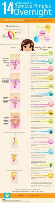 How To Get Rid Of Pimples Overnight Infographic