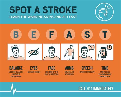 Signs Of A Stroke Signs Of A Strokesigns Of A Stroke