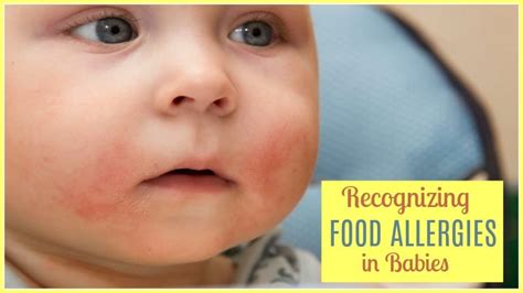Food allergies in babies are a reaction of the body's immune system to proteins found in food. Food Allergies in Babies Who Breastfeed - Common Signs and ...
