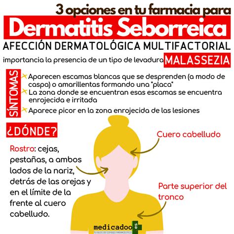 opciones en tu farmacia para la Dermatitis Seborreica Dermatitis seborreica Anatomía de la