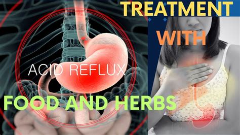 Unlocking The Secrets Of Acid Reflux Symptoms Treatment And