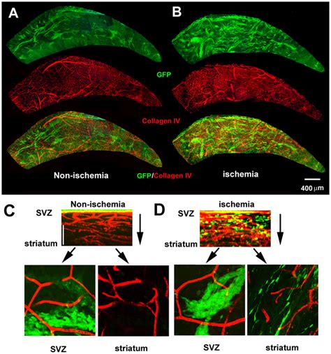 Microvascular Structure And Neuroblasts In The Vsvz Double