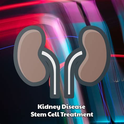 Kidney Disease Stem Cell Treatment Dreambody Clinic