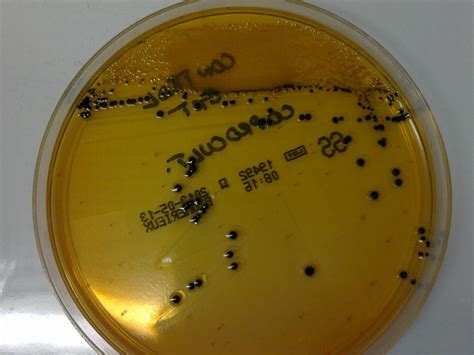 Continuing public health challenge // clinical infectious diseases. Salmonella enterica © | Microbiology, Salmonella, Clinic