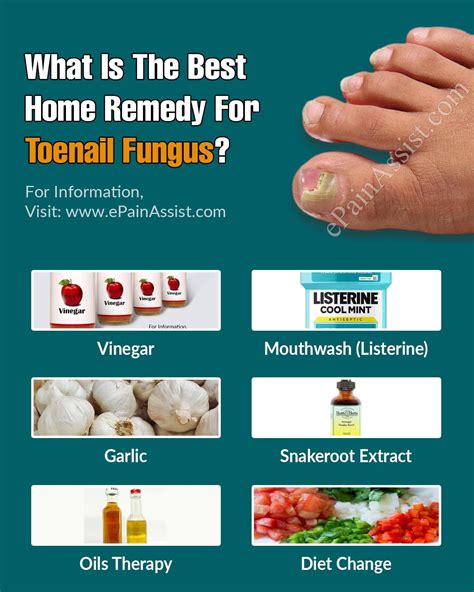 What Is The Best Home Remedy For Toenail Fungus