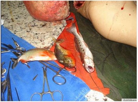 Gambar Mengerikan Lelaki Di Makan Ikan Piranha Berita Hebat