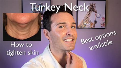 Turkey Neck Best Tightening Treatments Youtube
