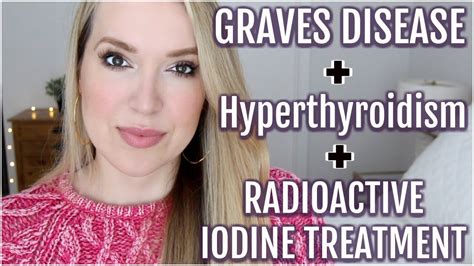 My Graves Disease Hyperthyroidism And Radioactive Iodine Treatment