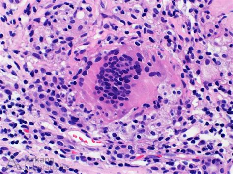 Giant Cells Teaching Points Arkana Laboratories