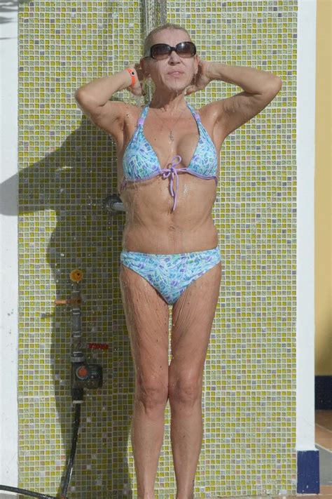 Tina Malone Shows Off Bikini Body For First Time Since Surgery To