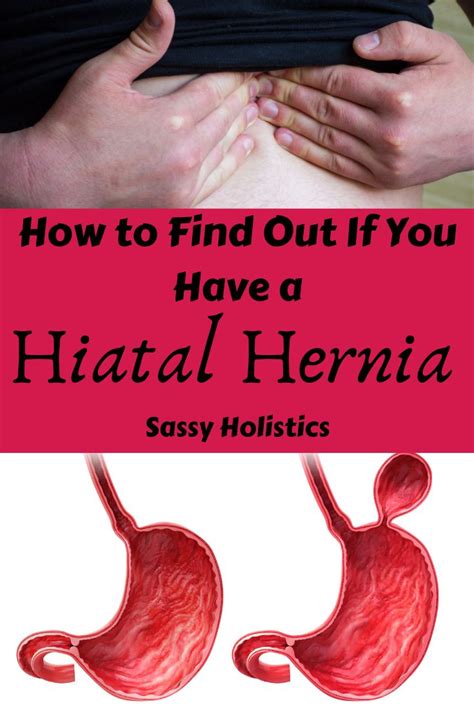 Can A Hiatal Hernia Cause Diarrhea Maybe You Would Like To Learn More