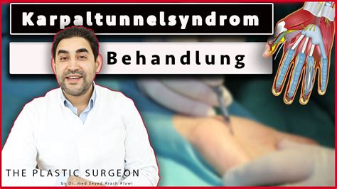 Muss Man Beim Karpaltunnelsyndrom Operieren Karpaltunnel Op Und Behandlung Dr Alawi Youtube