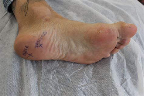 Simple Science: How to Make a Volcano with Kids