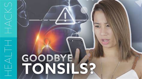 5 Signs You Need Your Tonsils Removed Youtube