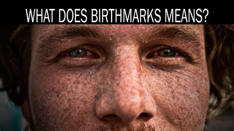 What Does Birthmarks Means Youtube