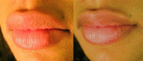 Natural Ways To Lighten Dark Lips Human N Health