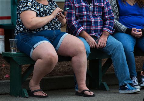 Obesity Rises Despite All Efforts To Fight It Us Health Officials Say The New York Times