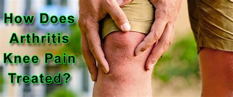 Arthritis Knee Pain Can Be Extremely Painful But Can Be Treated Chiropractor San Diego Dr