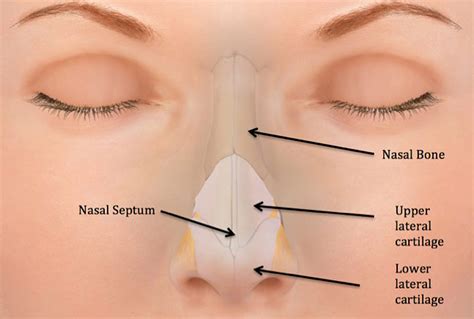 Nasal Fractures Septal Hematoma And Septal Perforation