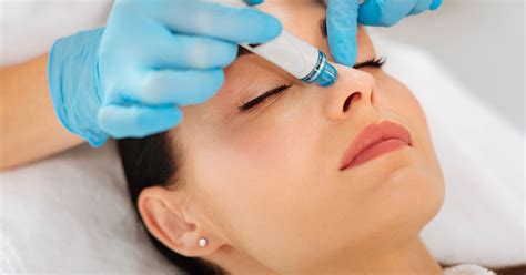 Why Hydrafacials Are The Holy Grail Of Facials — Health Insight