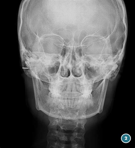 O Que é Telerradiografia
