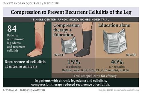 Compression Therapy To Prevent Recurrent Leg Cellulitis Nejm Resident 360