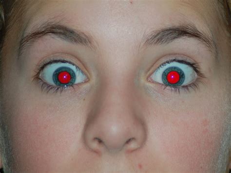 Gallery For People With Red Eyes