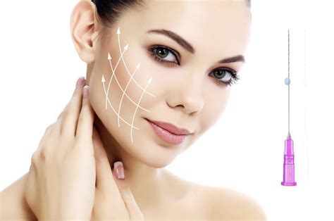 Everything You Need To Know About The Pdo Thread Lift Rsvp Beauty Clinic