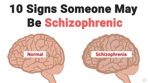 10 signs someone may be schizophrenic