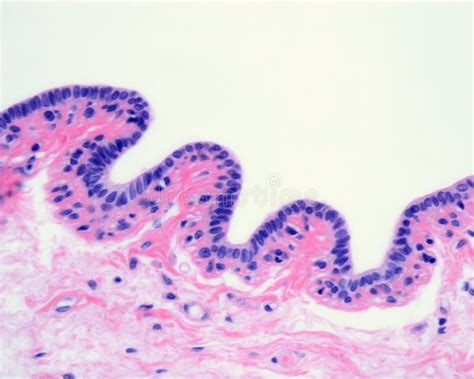 Human Breast Gland Lactiferous Duct Stock Photo Image Of Epithelium