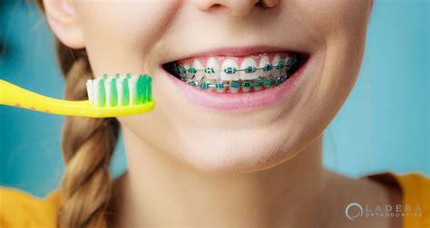 Keep Your Aligners Clean With These Tips