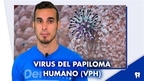 Virus Del Papiloma Humano Vph En La Boca Síntomas Y Tratamiento