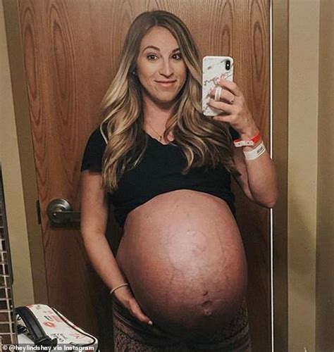 Quadruplets Mom Shares Jaw Dropping Pregnancy Transformations Reflects On Her Bodys