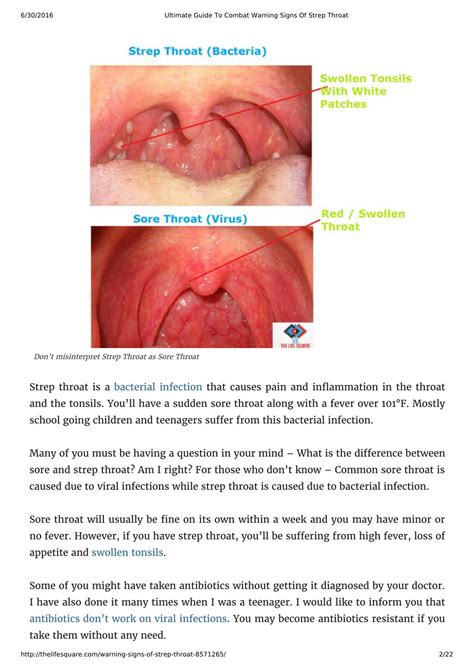 Ppt Ultimate Guide To Combat Warning Signs Of Strep Throat Powerpoint Presentation Id7362558