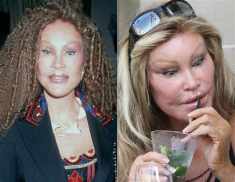 Jocelyn Wildenstein Picture Before And After Celeb Surgerycom