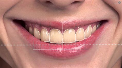 Smile Design Dentalogos Oral And Dental Health Clinic