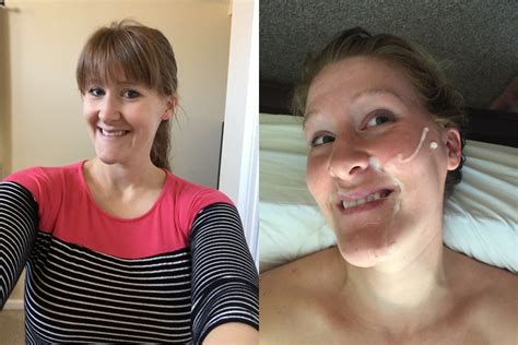Before And After Facial Zdjęcie Porno Eporner