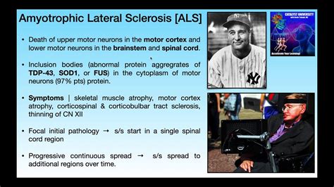 Amyotrophic Lateral Sclerosis Als Basics And Clinical Presentation
