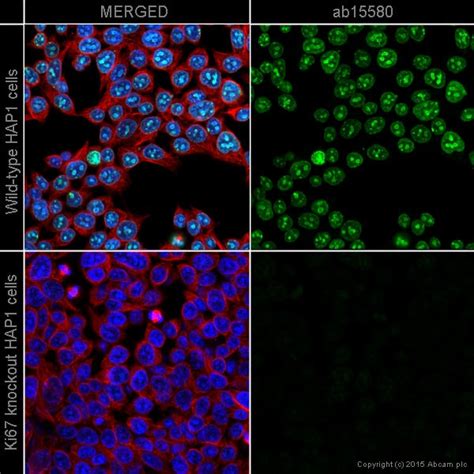 Anti Ki67 Antibody Ko Tested Ab15580 Abcam