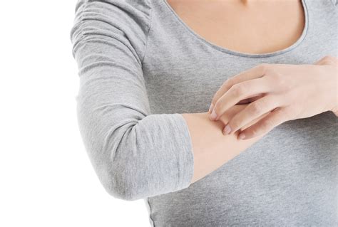 Arm Itch Causes And Treatments Md