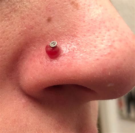 Piercing Bumps Everything You Need To Know Vlrengbr