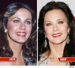 Lynda Carter Plastic Surgery Before And After Photos Celeblens