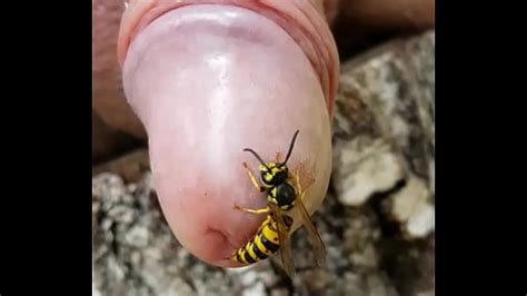The Wasp Stung On The Penis And Its Sting Got Stuck Xxx Videos Porno Móviles And Películas