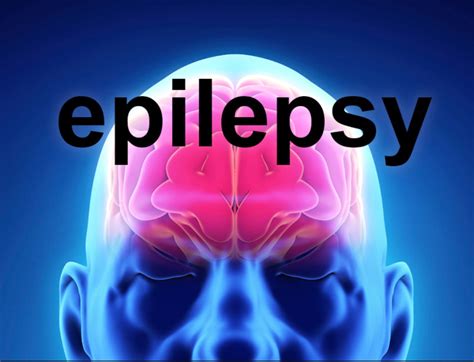 Epilepsy Dr Philip Blair Md