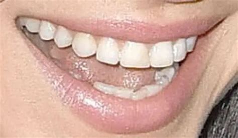 Mila Kunis Teeth Pictures
