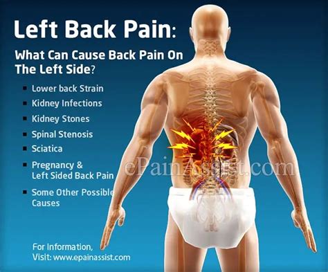 Lower Back Pain On Left Side And Bloating Whichpermit