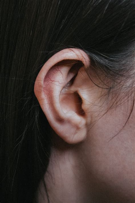 What Is Red Ear Syndrome