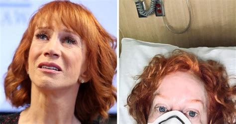 Kathy Griffin Blames Trump From Hospital Bed But Her Photo Has Some