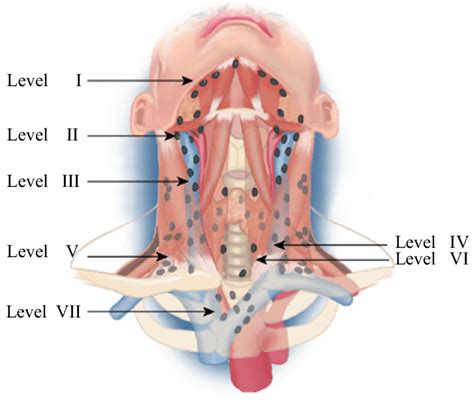 Lymph Node Back Of Neck Anatomy Vtct Lymph Nodes In The Head And Neck