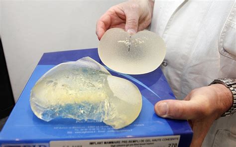 Removal Of Breast Implants Under The Muscle Car